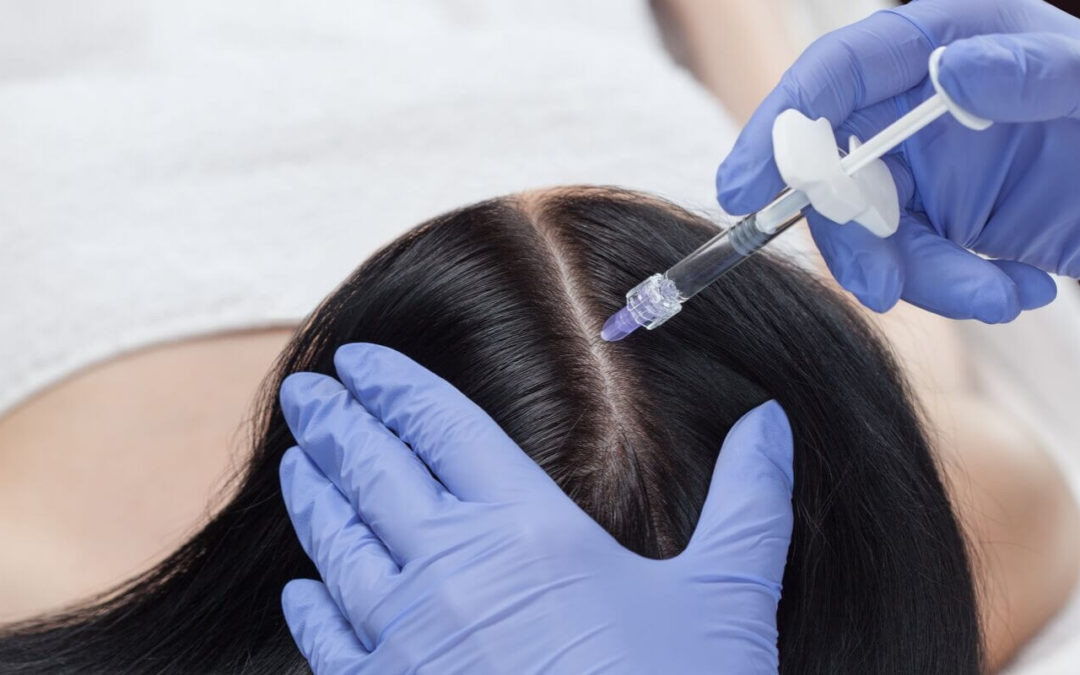 Dr hair filler. Мезотерапия для волос от выпадения. Мезотерапия для волос от выпадения у женщин.